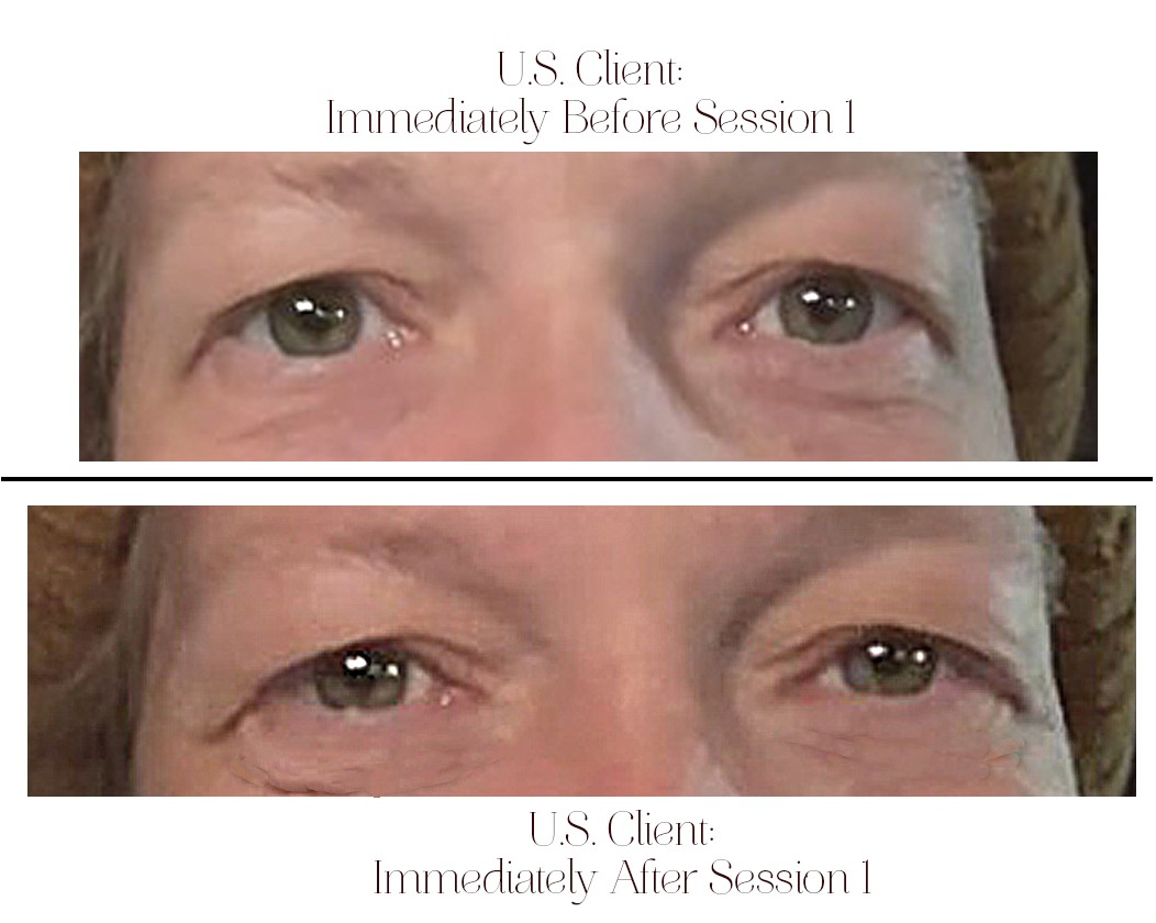 Note that there is already more depth, ease, warmth + less tension in the 'after' version